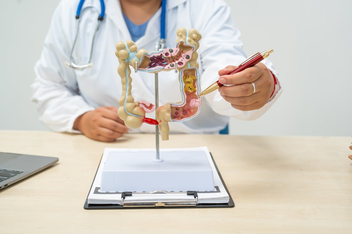 
                Quels sont les symptômes du cancer du côlon ? 
                            