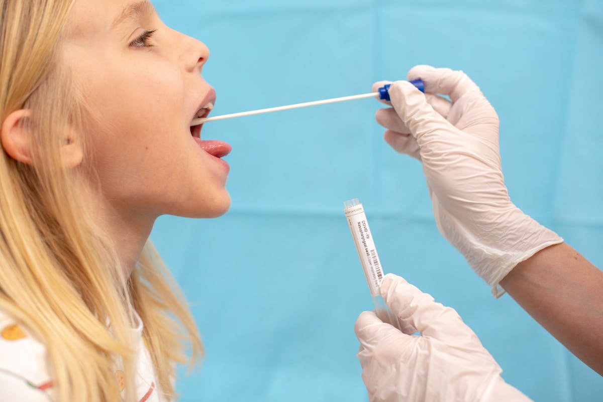 
                Qu'est-ce qu'une angine de Vincent ? 
                            