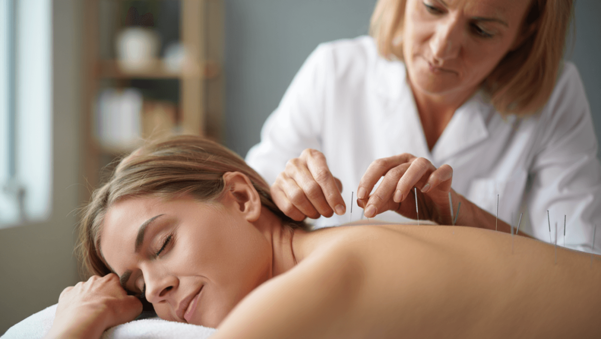 Acupuncture pour arrêter de fumer : est-ce efficace ?