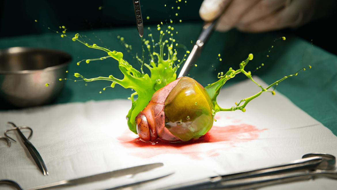 Faut-il vraiment « nettoyer » sa vésicule biliaire ?