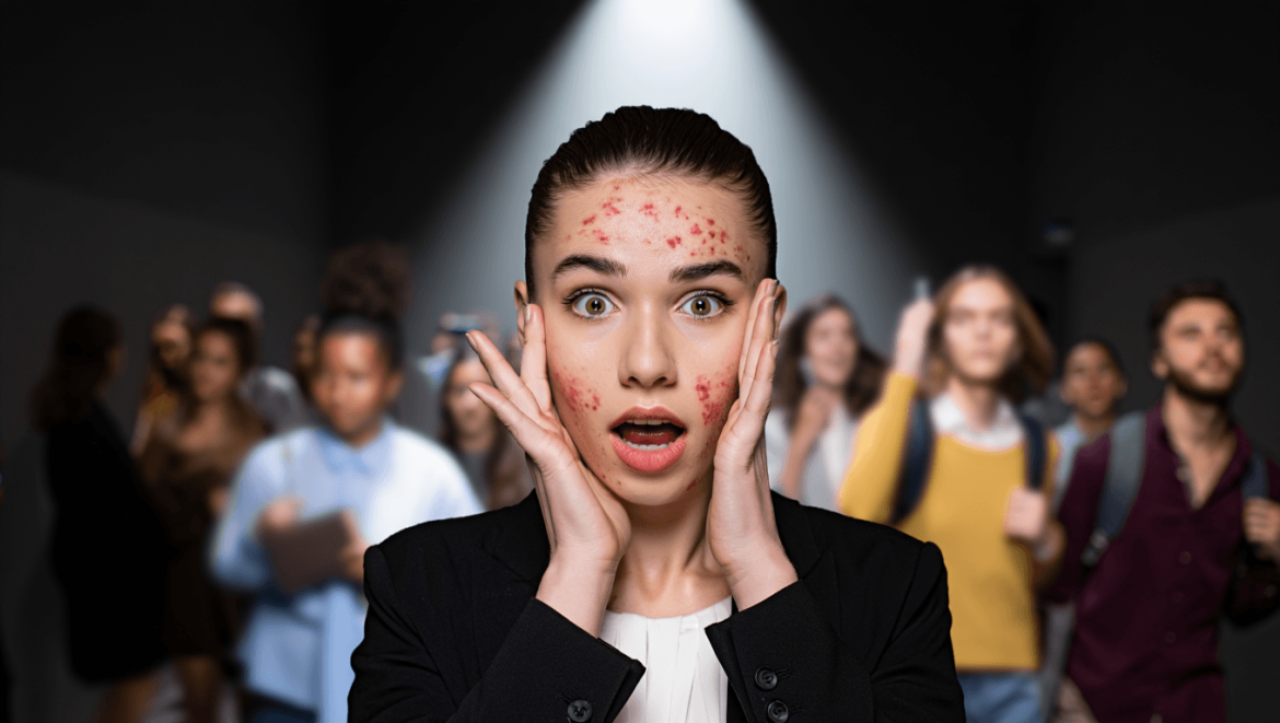 Stress et problèmes de
peau